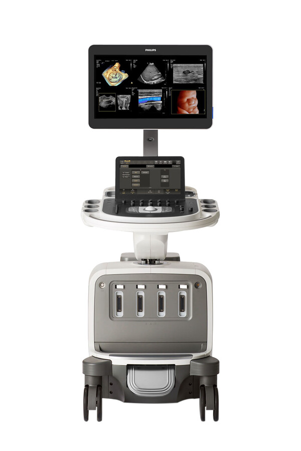 필립스 고사양 초음파 시스템 에픽 엘리트(EPIQ Elite)